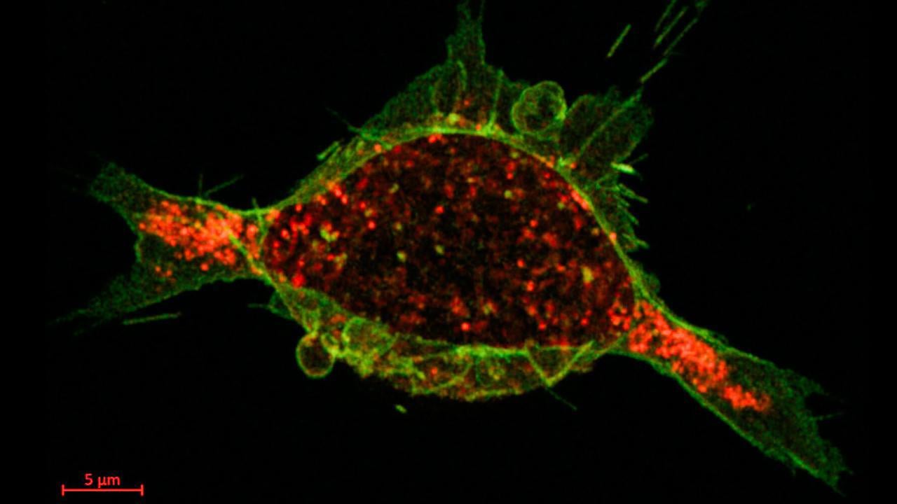 cancercell