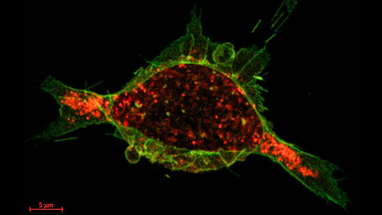 cancercell