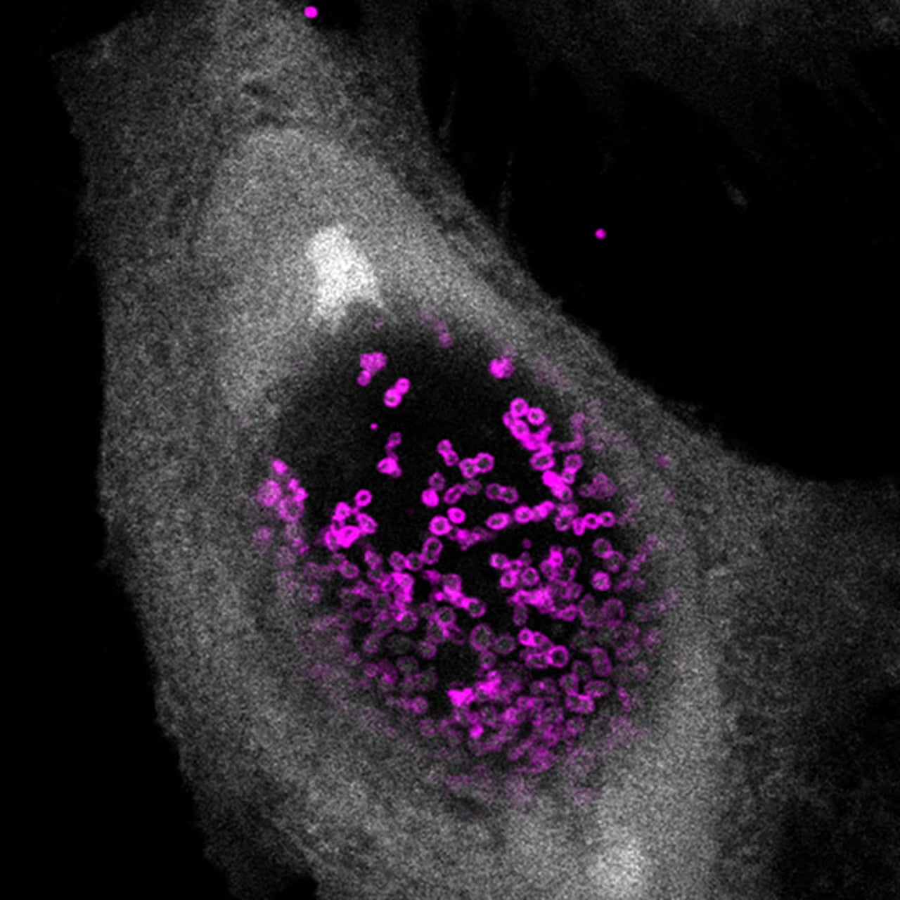 Caption: Confocal fluorescence microscopic image displaying a human cell (gray) infected with Chlamydia trachomatis (magenta).