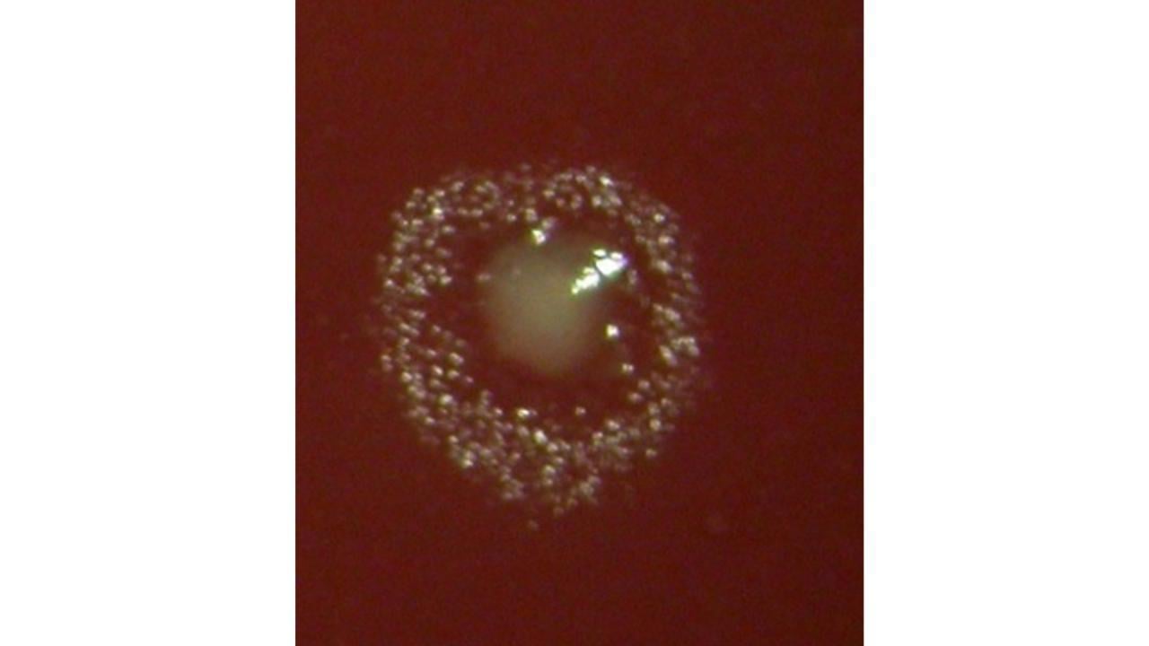 Filifactor alocis m&aring; vara en oral patogen, men den ser sn&auml;ll ut vid odling