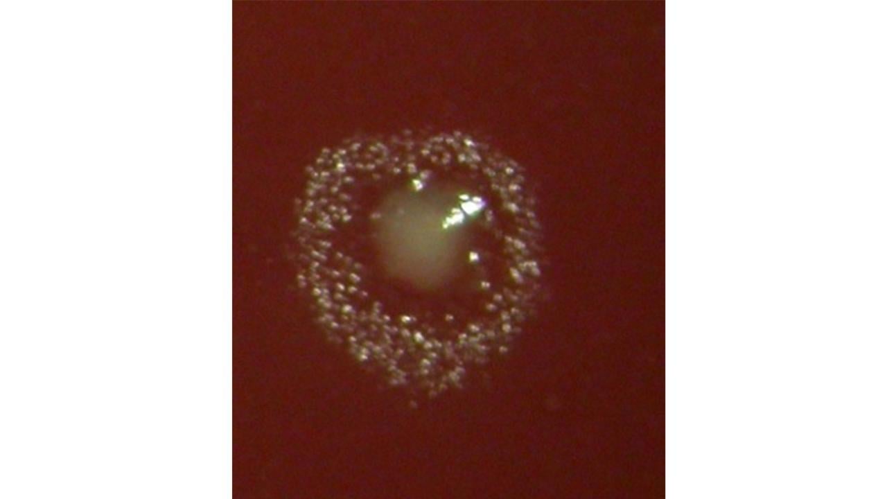Filifactor alocis