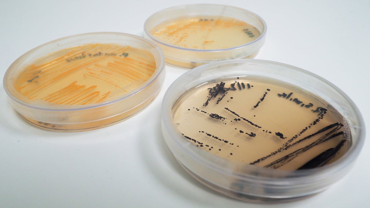 Petri dishes