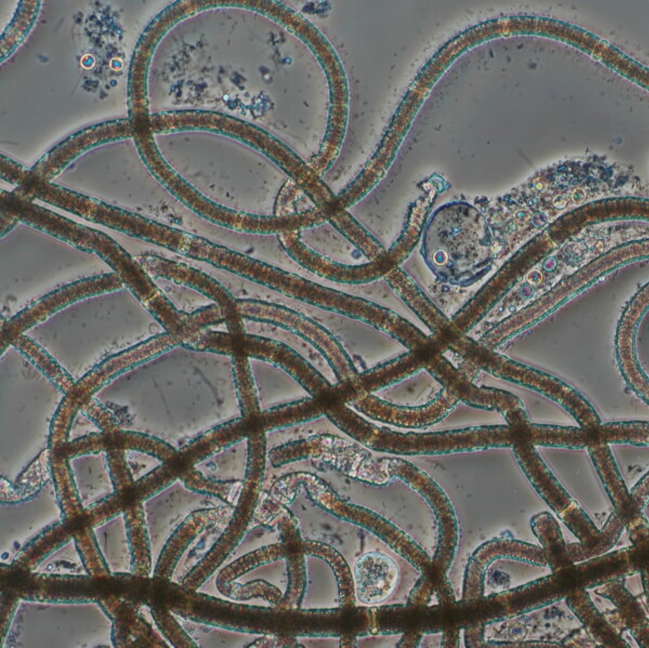 Mikroskopbild p&aring; cyanobakterien Nodularia spumigena.