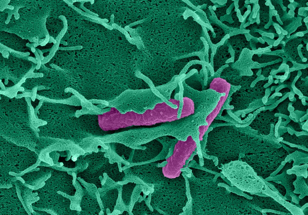 Coloured electron microscopy image of a nascent plasma membrane ruffle enclosing a bacterium which invades an intestinal epithelial cell. Sample: Lalitha Tadala; Image acquisition: Ram&oacute;n Cervantes-Rivera; Artistic rendering: Atin Sharma. MIMS, Ume&aring; University.