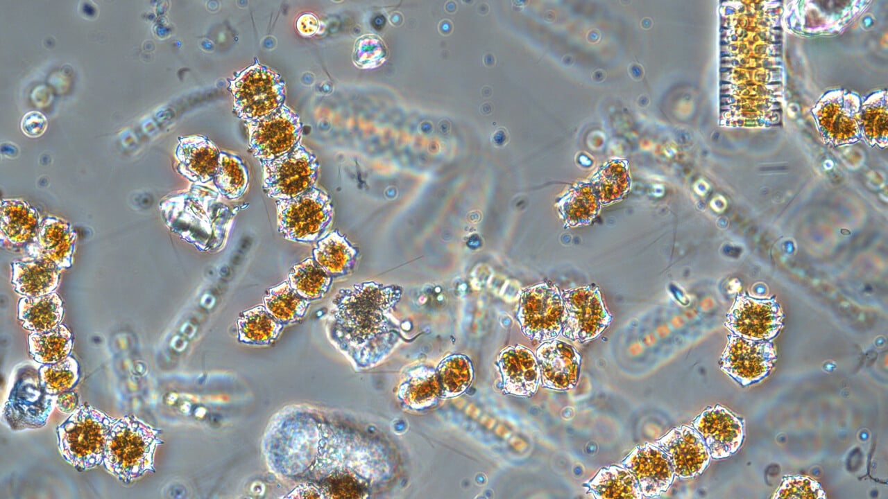 Mikroskopbild p&aring; v&auml;xtplankton