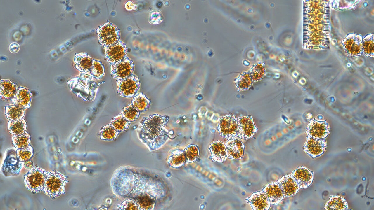 Mikroskopbild p&aring; v&auml;xtplankton