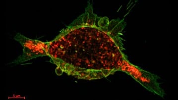 cancercell