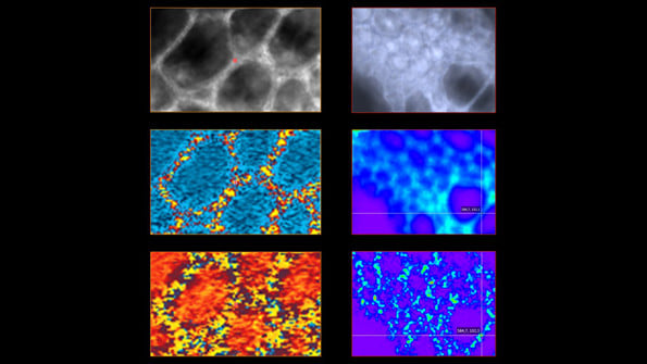 Label-free chemical imaging of biological samples. Top row: focus image of plant sections. Middle row: aromatic carbon vibrations (related to lignin), detected by OPTIR (left) and Raman (right) spectroscopy. Bottom row: OPTIR phase image (left) and OPTIR aromatic carbon distribution (lignin).