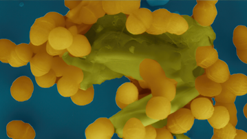 Bild från elektronmikroskop som visar hur Enterococcus faecalis-bakterier klumpar ihop sig för att dela bland annat antibiotikaresistens med varandra.