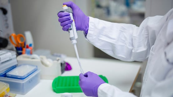 Pipettering av prov.