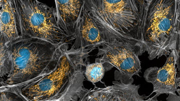 Mitochondria are the powerhouses of the cells, generating the energy the cells need to do their tasks and to stay alive. Researchers have studied mitochondria for some time because when these cell organelles don't as well as they should, several diseases develop. In this photograph of cow cells taken with a microscope, the mitochondria were stained in bright yellow to visualize them in the cell. The large blue dots are the cell nuclei and the gray web is the cytoskeleton of the cells.