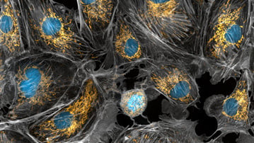 Mitochondria are the powerhouses of the cells, generating the energy the cells need to do their tasks and to stay alive. Researchers have studied mitochondria for some time because when these cell organelles don't as well as they should, several diseases develop. In this photograph of cow cells taken with a microscope, the mitochondria were stained in bright yellow to visualize them in the cell. The large blue dots are the cell nuclei and the gray web is the cytoskeleton of the cells.