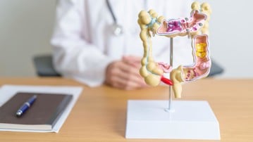 Doctor with human Colon anatomy model. Colonic disease, Large Intestine, Colorectal cancer, Ulcerative colitis, Diverticulitis, Irritable bowel syndrome, Digestive system and Health concept