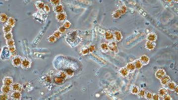 Mikroskopbild på växtplankton från Örefjärden, Västerbottens län