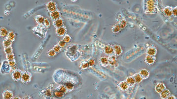 Spring bloom of phytoplankton through a microscope.
