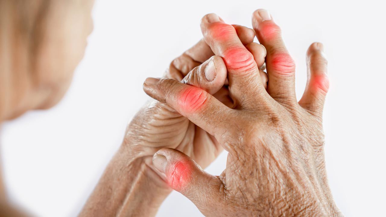 Asian woman hand suffering from joint pain with gout in finger