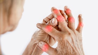 Asian woman hand suffering from joint pain with gout in finger
