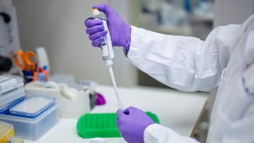 Pipettering av prov.