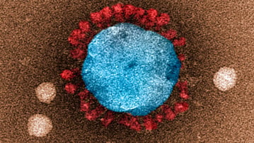 Bilder skapade av UCEM (Umeå Center for Electron Microscopy), provpreparering Anna Överby, Umeå Universitet. Bilderna är tagna med transmissions elektron mikroskop på UCEM.<br/><br/>Coronavirus är producerade från cellkultur av Ebba Rosendal och Anna Överby. Anna Överby är gruppledare på Klinisk Mikrobiologi. Virus är kemiskt fixerade och kontrasterade med tungmetall salt, metoden kallas negative staining. Bilder är tagna med elektronmikroskopet Talos L120 och kamera Ceta (båda tillverkade av Thermo Fisher Scientific). En viruspartikel är ungefär 100 nm i diameter.