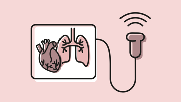 Puffbild för klinisk fysiologi vid Institutionen för diagnostik och intervention