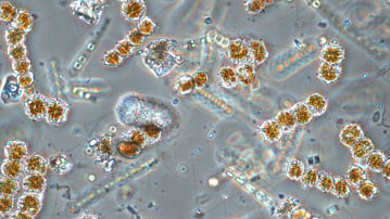 mikroskopbild på olika växtplankton
