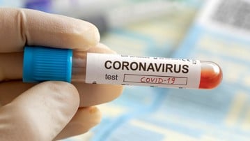 Sjuksköterskas hand som håller ett blodprov som test för coronavirus.