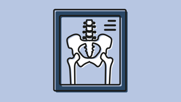 Puffbild för diagnostisk radiologi vid Institutionen för diagnostik och intervention