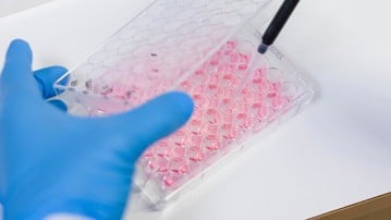 Biträdande universitetslektor vid Institutionen för klinisk mikrobiologi Enhet: Avdelningen för virologi