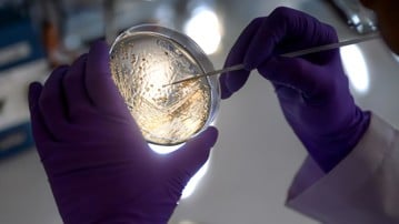 A researcher studying microbial stress responses works with bacteria on a petri dish in the lab