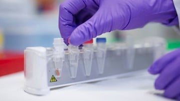 Magnetiska microbeads kopplade till antikroppar mot specifika proteinsekvenser används för att isolera felveckat och aggregerat protein med hjälp av en magnet.