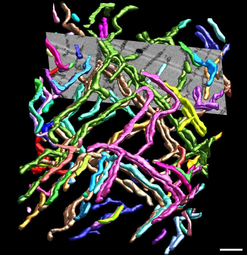 Electron microscopy image