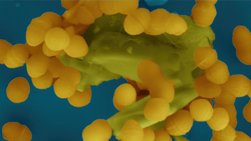 Bild från elektronmikroskop som visar hur Enterococcus faecalis-bakterier klumpar ihop sig för att dela bland annat antibiotikaresistens med varandra.