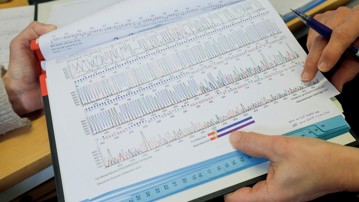 Sekvenseringsresultat från ett prov från en patient eller en forskningsperson. Resultatet kan visa om det finns en mutation känd för att orsaka ALS.