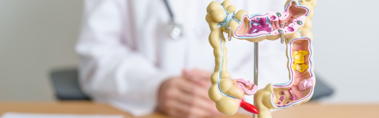 Doctor with human Colon anatomy model. Colonic disease, Large Intestine, Colorectal cancer, Ulcerative colitis, Diverticulitis, Irritable bowel syndrome, Digestive system and Health concept