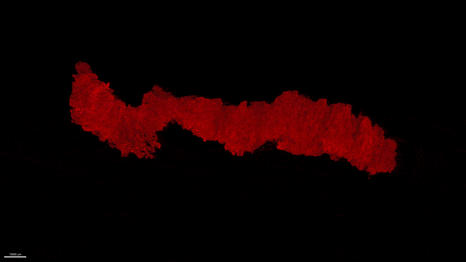 Insulin producing islets of Langerhans in the human pancreas