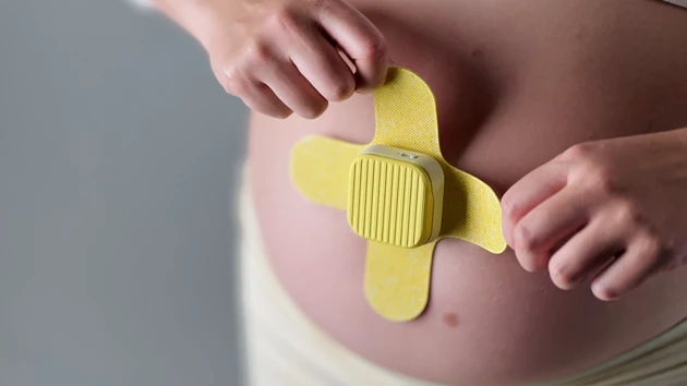 Creating a feeling of security for expectant parents in rural areas.