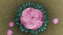 Bild på corona-virus tagna i mikroskop.