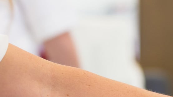 Sjuksköterskas hand som ordnar med kanyl i arm på en person vid blodgivning.