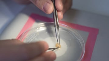 Biträdande universitetslektor, ST-läkare vid Institutionen för integrativ medicinsk biologi (IMB)
