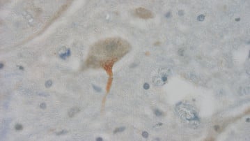 Bild på helveckad protein i nervcell