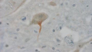 Bild på helveckad protein i nervcell