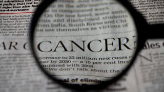 Närbild på ett förstoringsglas som visar ordet Cancer från en tidningstext