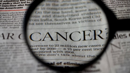 Närbild på ett förstoringsglas som visar ordet Cancer från en tidningstext