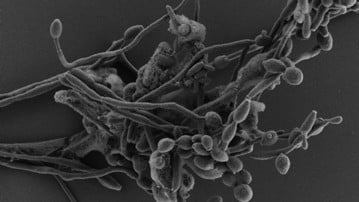 Candida albicans