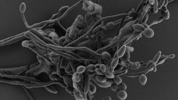 Candida albicans