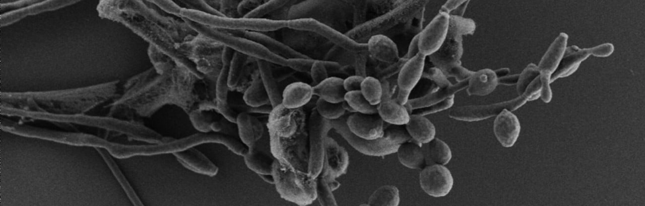 Candida albicans