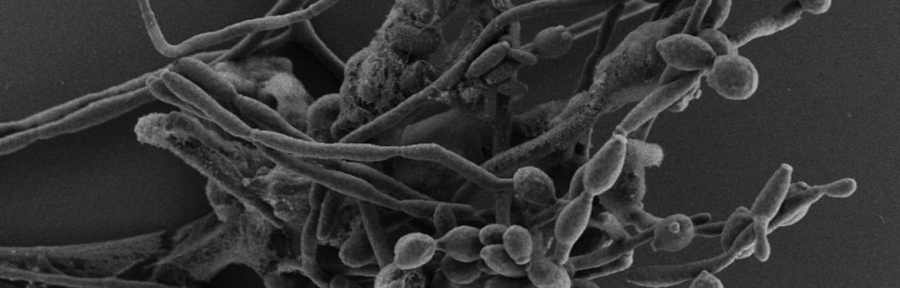 Candida albicans