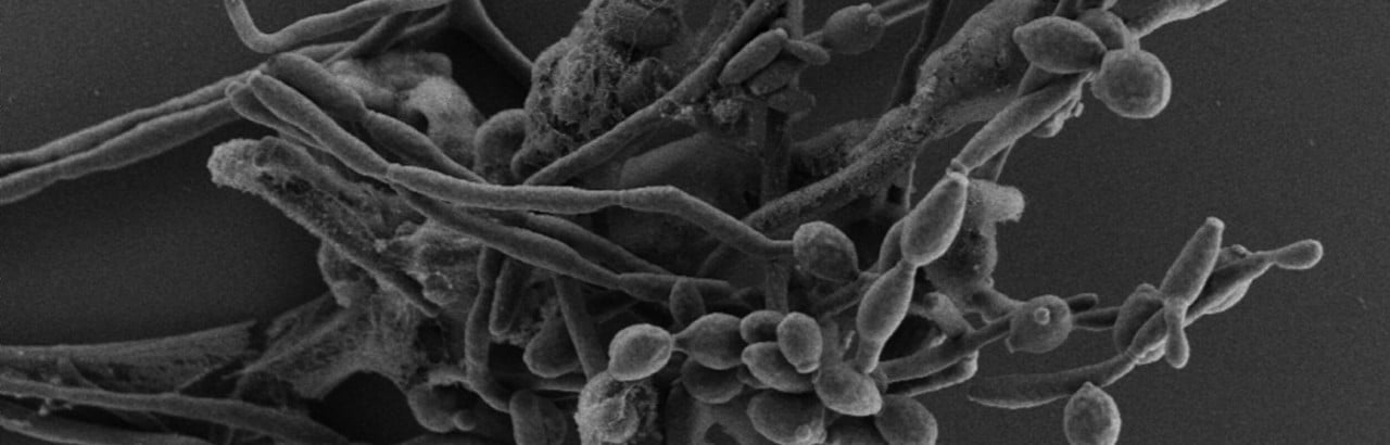 Candida albicans
