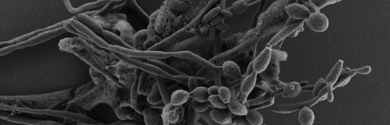 Candida albicans
