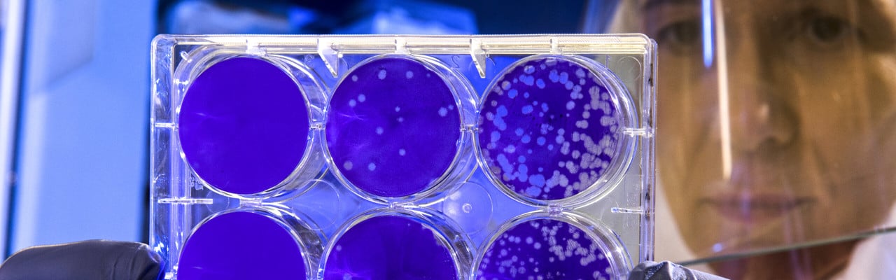 Odling av coronavirus.